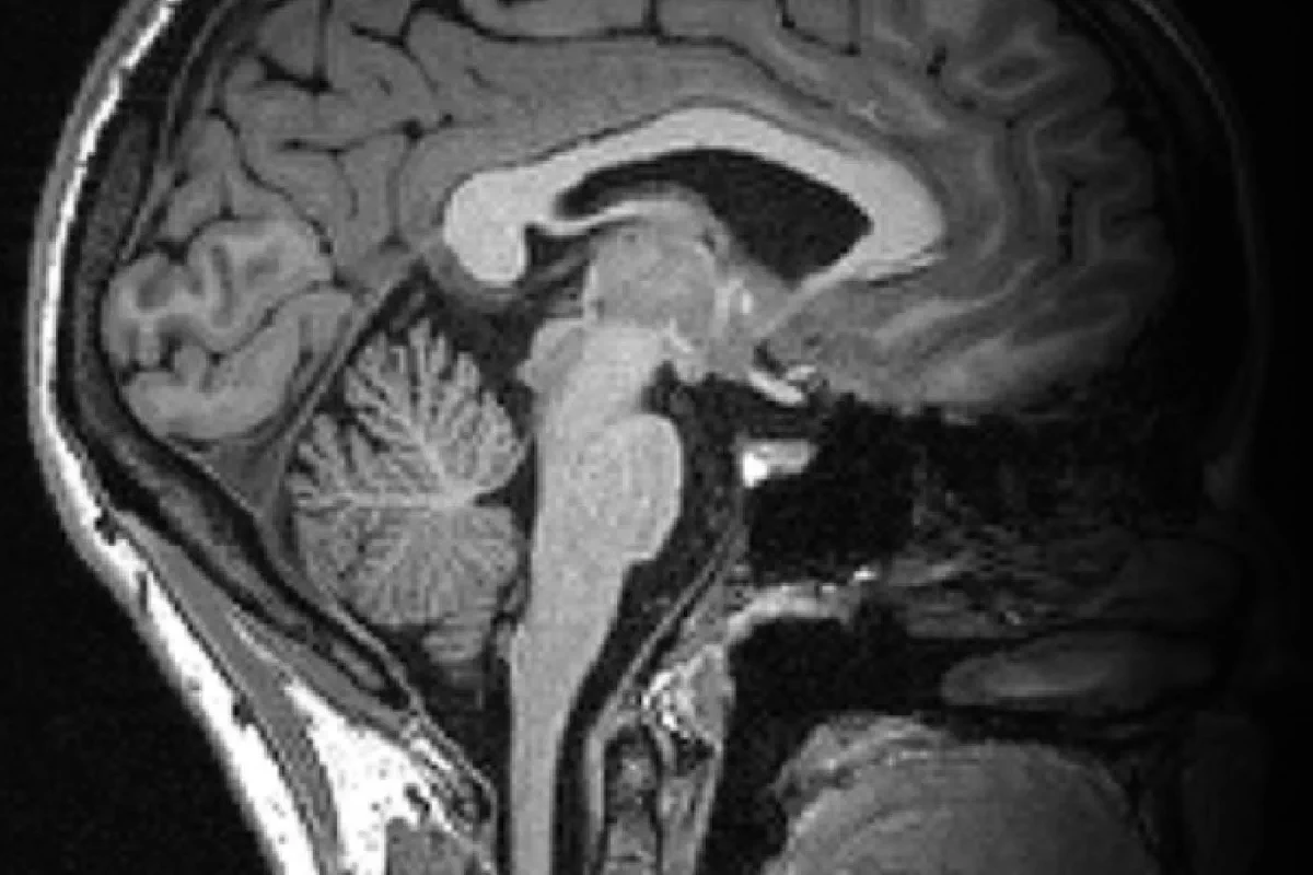 Sagittal MPRAGE brain scan produced by the centre's imaging pipeline